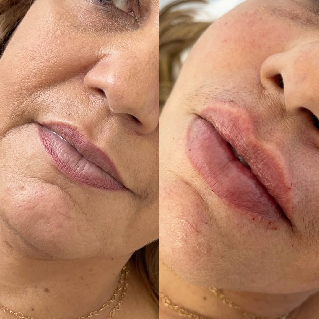 Comparação de antes e depois de paciente da clínica, caso 03