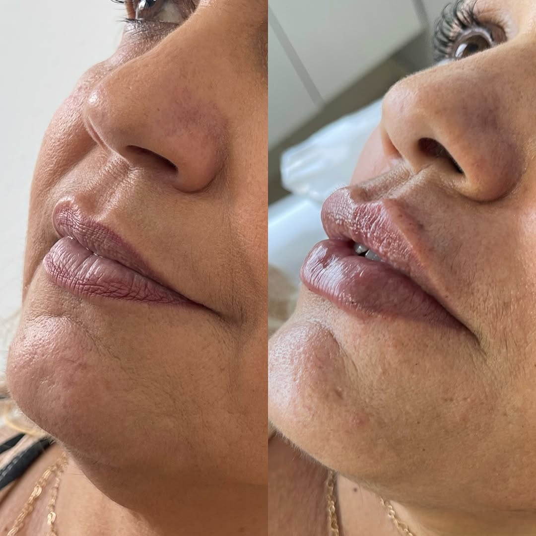 Comparação de antes e depois de paciente da clínica, caso 05